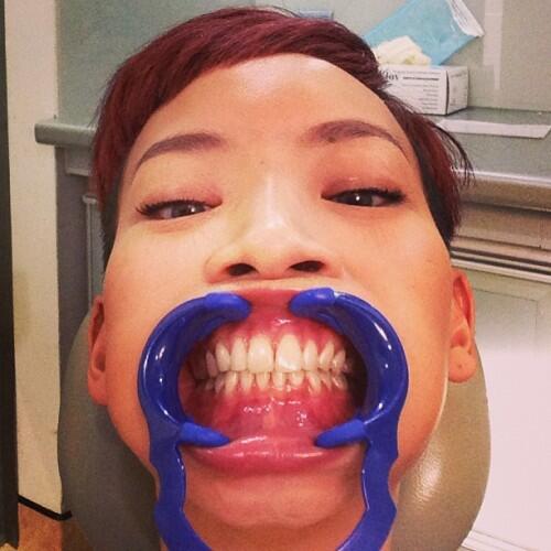 straight teeth
